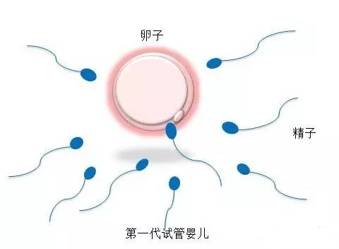 严重少弱精案例